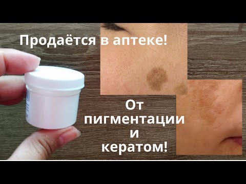 Видео: От пигментации и от кератом! Есть в любой аптеке!