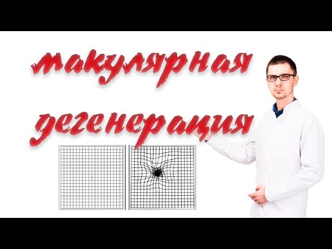 Видео: Возрастная макулярная дегенерация | сухая и влажная форма ВМД