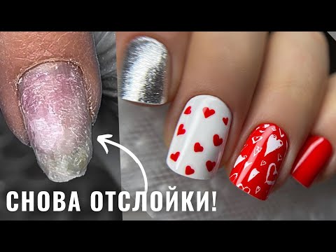 Видео: ОТСЛОЙКИ НА НОГТЯХ! В чем причина? ДИЗАЙН ногтей на 14 ФЕВРАЛЯ