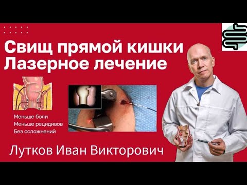 Видео: Свищ прямой кишки (свищ заднего прохода, параректальный свищ). Лазерное лечение.