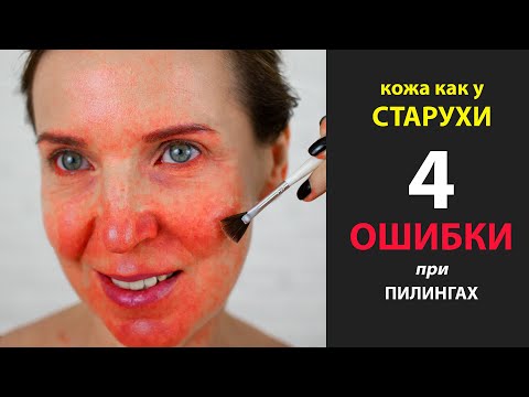 Видео: Осложнения после Пилинга - 4 частые ошибки