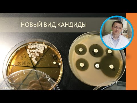 Видео: Редкая находка - Candida inconspicua. Патогенный вид кандиды, выделен впервые в РФ (2020)
