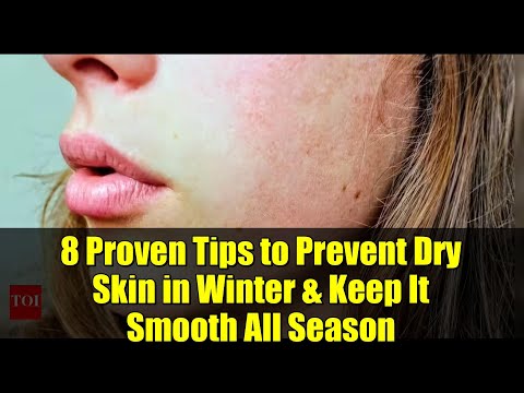 Видео: 8 проверенных советов, как предотвратить сухость кожи зимой и сохранить ее гладкой в ​​течение вс...