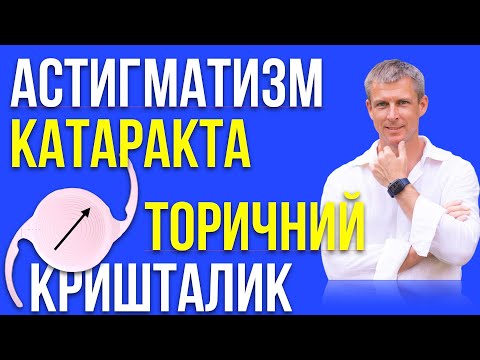 Видео: Катаракта, астигматизм и торические хрусталики глаза