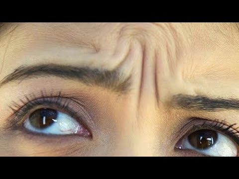 Видео: Глубокие морщины на переносице. Глубокие морщины на лбу. Простой и бесплатный способ избавиться.