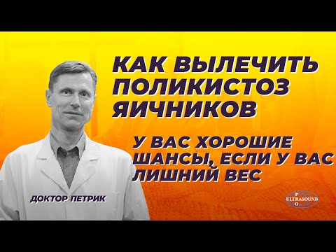 Видео: Как вылечить поликистоз яичников. У вас хорошие шансы, если у вас лишний вес.