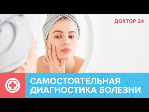 Видео: Как САМОСТОЯТЕЛЬНО обнаружить БОЛЕЗНИ? ТЕМЫ НЕДЕЛИ | Доктор 24