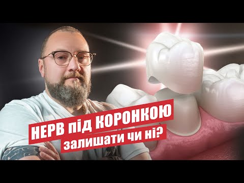 Видео: 🇺🇦 Нужно ли удалять нерв под коронкой?