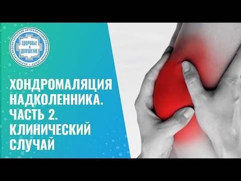 Видео: 🦵 👉 Хондромаляция надколенника. Часть 2. Клинический случай