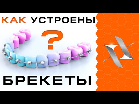 Видео: КАК РАБОТАЮТ БРЕКЕТЫ | Устройство брекет-системы