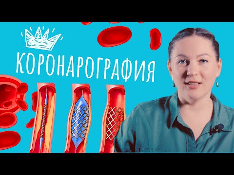 Видео: Коронарография -- "королева" кардиологических процедур.