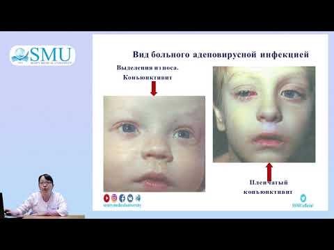 Видео: Грипп и ОРВИ у детей