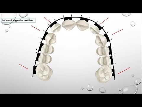 Видео: Изгибы первого порядка (внутрь и наружу)