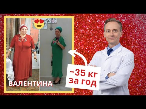 Видео: Валентина -35 кг за год. Как похудеть, если с детства склонен к полноте?