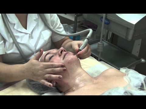 Видео: Вакуумный массаж лица на аппарате Starvac