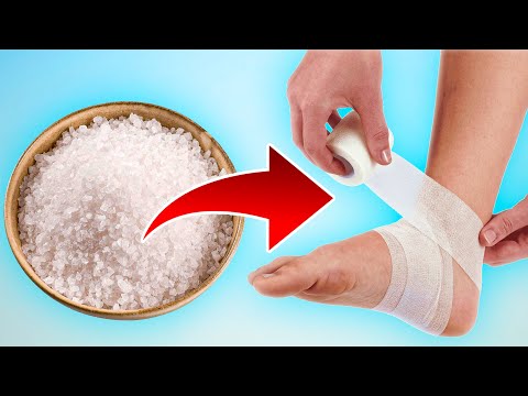 Видео: СОЛЕВЫЕ ПОВЯЗКИ ЛЕЧАТ ВСЁ! Забытый метод эффективного лечения!