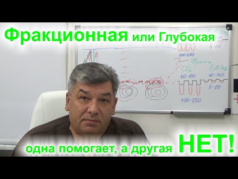 Видео: Почему фракционная лазерная шлифовка не справляется с рубцами постакне.#8