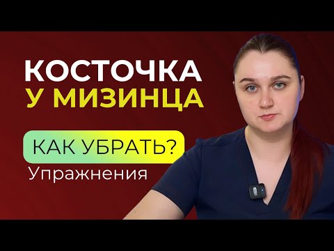 Видео: Шишка на мизинце, как убрать косточку на ноге?