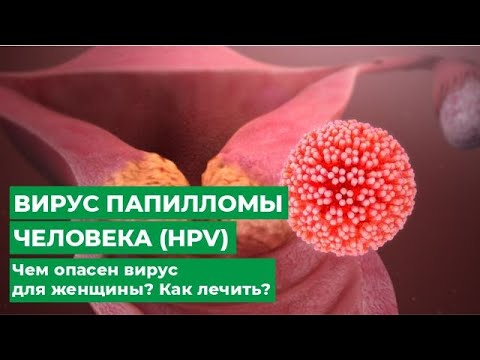 Видео: Вирус папилломы человека (HPV) Чем опасен вирус для женщины? Как лечить?