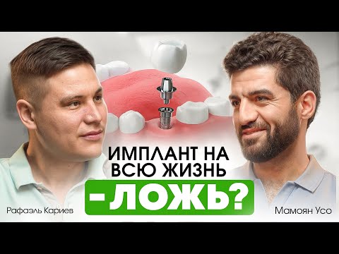 Видео: МИФЫ О ЗУБНЫХ ИМПЛАНТАХ: Это больно? Как избежать отторжения и что нужно знать пациенту? Усо Мамоян