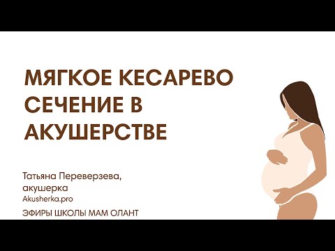 Видео: МЯГКОЕ КЕСАРЕВО СЕЧЕНИЕ В АКУШЕРСТВЕ