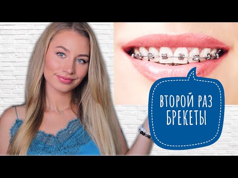 Видео: БРЕКЕТЫ ВТОРОЙ РАЗ 😬 СКОЛЬКО, КАК, ЗАЧЕМ? Ошибки после снятия брекетов