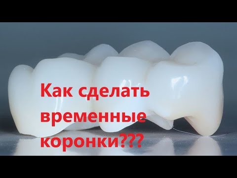 Видео: Изготовление пластмассовых коронок. Временные коронки из пластмассы, изготовление.