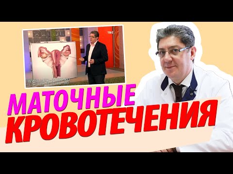 Видео: Маточные кровотечения: причины, как остановить, лечение