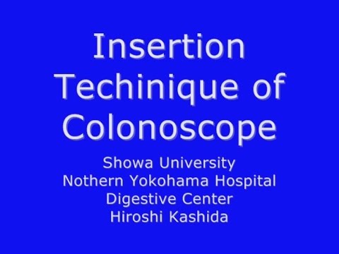 Видео: #EndoExpert Лекция проф. Hiroshi Kashida "Методика введения колоноскопа"