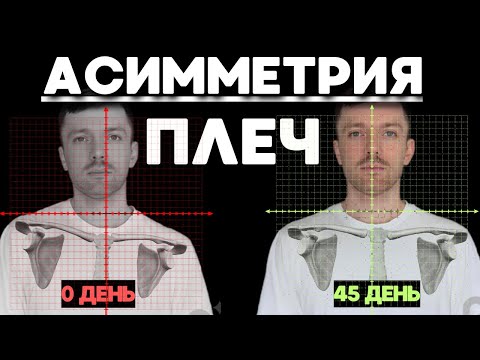 Видео: Одно плечо выше? Полное руководство от Б до Ю по выравниванию плеч