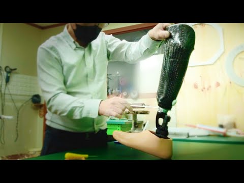 Видео: Процесс представления прекрасной жизни с новой «протезной ногой»
