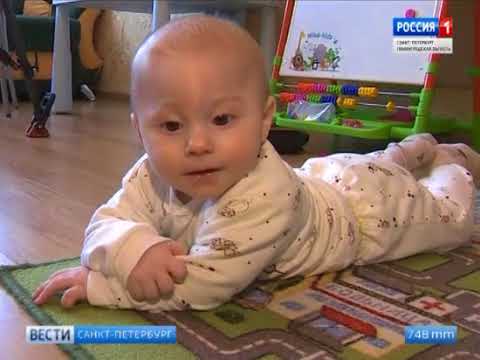 Видео: Миша Эсолайнен, 5 месяцев, краниосиностоз