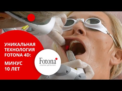 Видео: Лазерная подтяжка лица Fotona 4D: лифтинг эффект, омоложение кожи