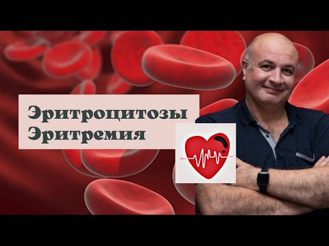 Видео: Эритроцитозы и Эритремия: от классификации до методов лечения