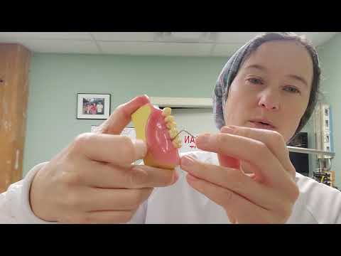 Видео: Как правильно измерять пародонтальные карманы