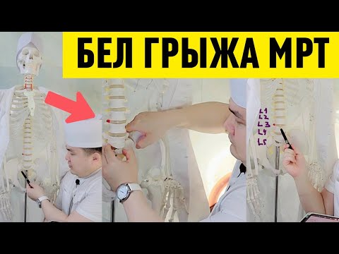 Видео: МРТ ШОК ХУЛОСА: ГРЫЖА, ПРОТРУЗИЯ ВА ОСТЕОХОНДРОЗ НИМА ДЕГАНИ? СКЕЛЕТДА ЯҚҚОЛ КЎРСАТИЛАДИ!