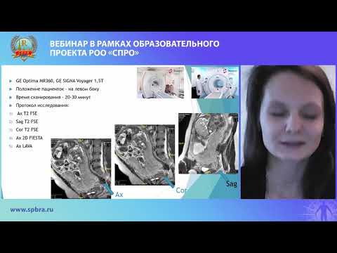 Видео: Герасимова И.М. Критерии диагностики placenta accreta методом магнитно-резонансной томографии