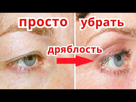 Видео: Нависшее Веко,Кожа Вокруг Глаз разгладится СРАЗУ! Маска от Дряблого века и морщин