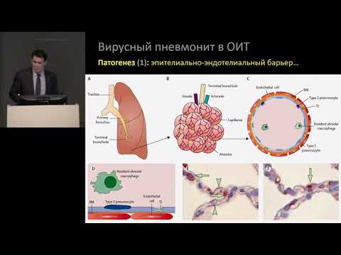 Видео: Вирусный пневмонит Кузьков В В 2019