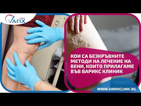 Видео: Кои са безкръвните методи на лечение на вени, които прилагаме във Варикс клиник