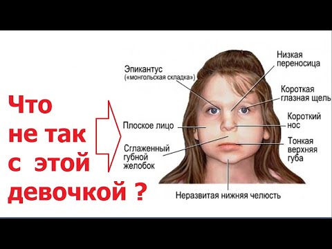Видео: Причины нарушений развития речи, психики или аутизма - как их установить по внешнему виду ребенка