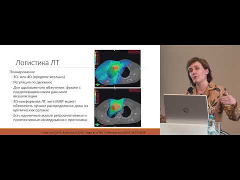 Видео: Лучевая терапия пациентов с тимомами (кому? когда?)