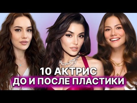 Видео: 10 ТУРЕЦКИХ АКТРИС, КОТОРЫЕ СИЛЬНО ИЗМЕНИЛИСЬ ПОСЛЕ ПЛАСТИКИ