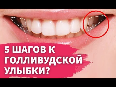 Видео: 5 секретов голливудской улыбки