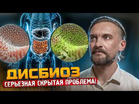 Видео: СИМПТОМЫ ДИСБИОЗА: КАК РАСПОЗНАТЬ И ЛЕЧИТЬ СЕРЬЕЗНУЮ ПРОБЛЕМУ?