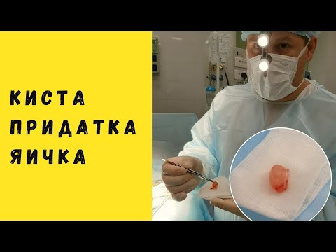 Видео: КИСТА ПРИДАТКА ЯИЧКА | ЧТО ДЕЛАТЬ?