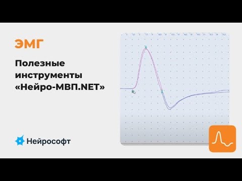 Видео: ЭМГ: Полезные инструменты в работе с ПО «Нейро-МВП.NET»