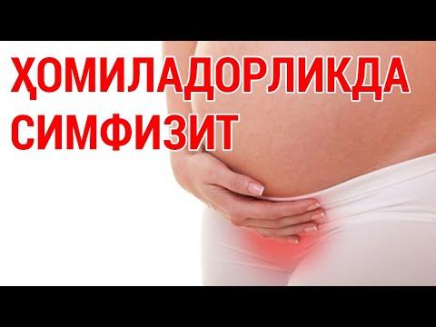 Видео: ҲОМИЛАДОРЛИКДА СИМФИЗИТ: даволаш бўйича тавсиялар