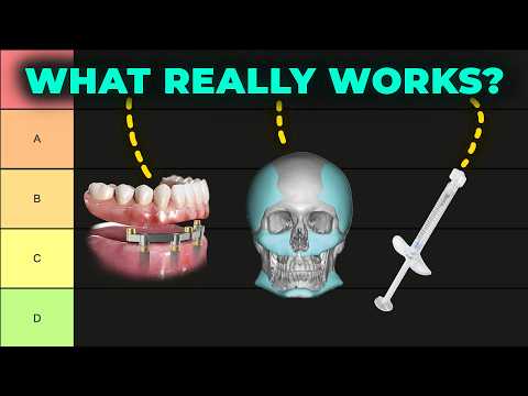 Видео: ULTIMATE Список уровней хирургии Looksmaxxing