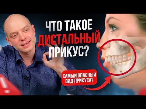 Видео: ДИСТАЛЬНЫЙ ПРИКУС, нужно ли его исправлять? Самый опасный вид неправильного прикуса?